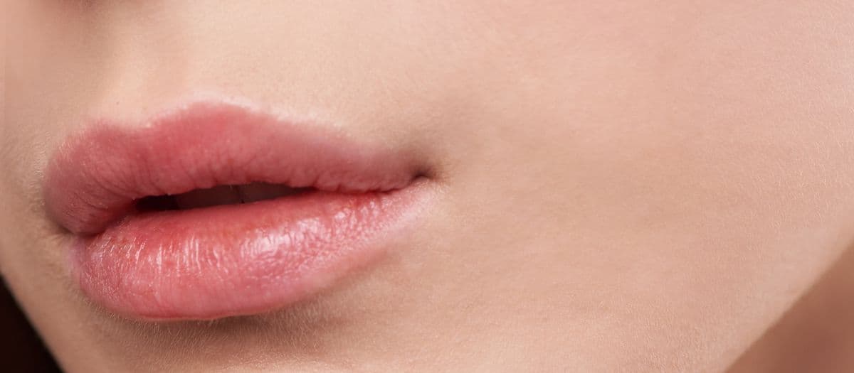 Lip Lift versus Lip Filler